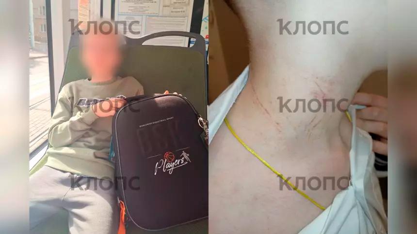 В Калининграде одноклассник регулярно избивает 10-летнего мальчика и показывает на нём удушающие приёмы В Калининграде одноклассник регулярно избивает 10-летнего мальчика и показывает на нём удушающие приёмы