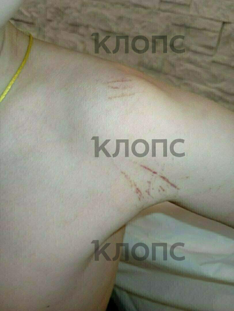 В Калининграде одноклассник регулярно избивает 10-летнего мальчика и показывает на нём удушающие приёмы В Калининграде одноклассник регулярно избивает 10-летнего мальчика и показывает на нём удушающие приёмы