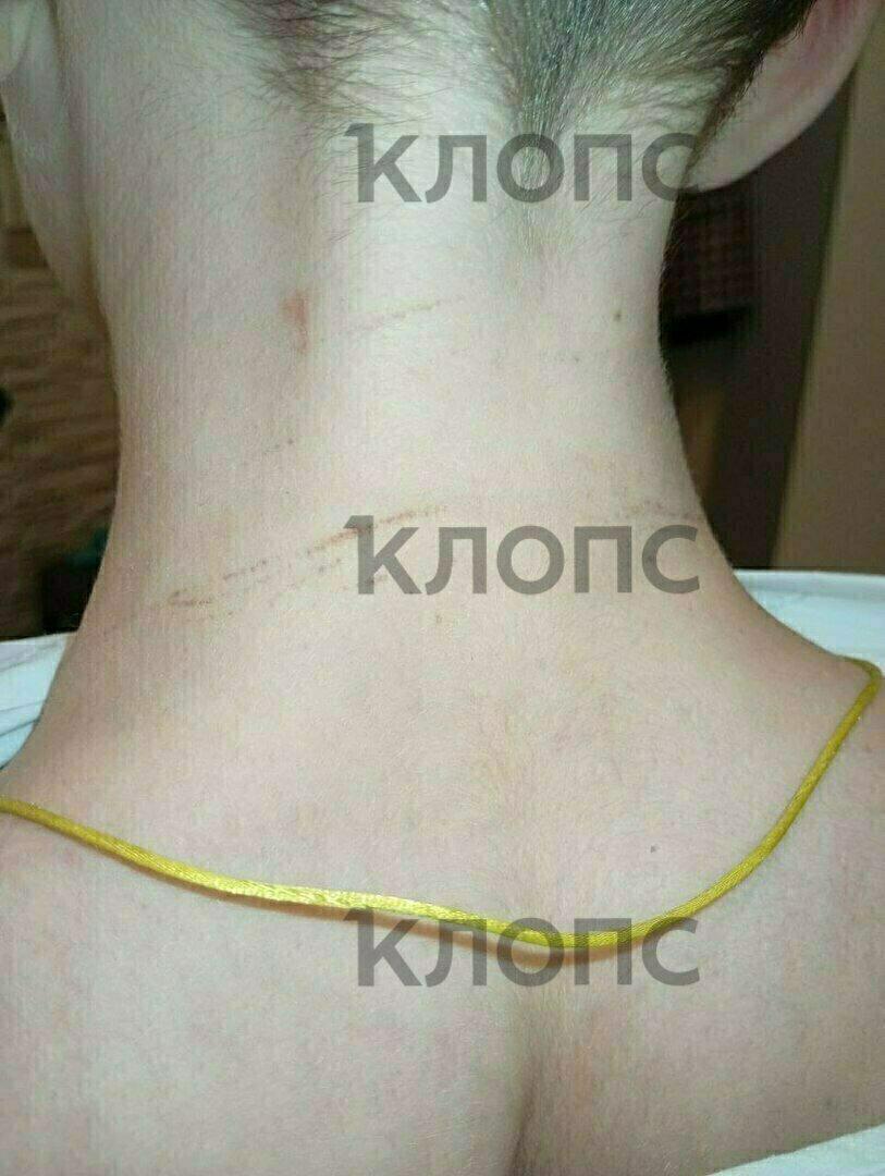 В Калининграде одноклассник регулярно избивает 10-летнего мальчика и показывает на нём удушающие приёмы В Калининграде одноклассник регулярно избивает 10-летнего мальчика и показывает на нём удушающие приёмы