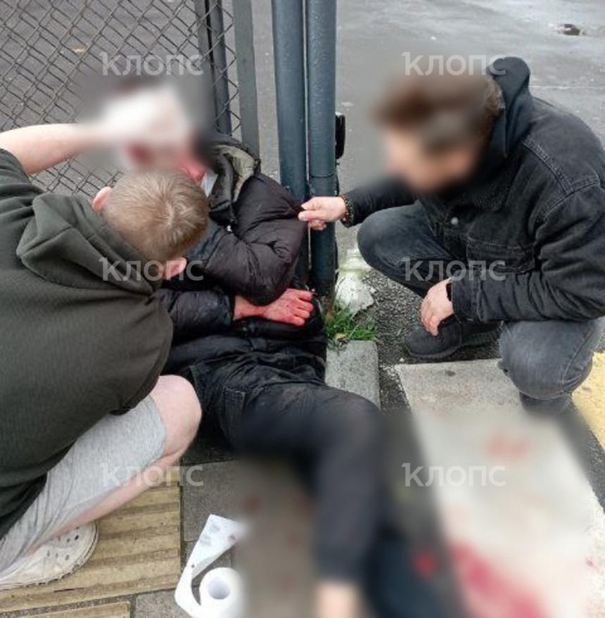Калининградцы бросились на помощь окровавленному парню, наутро раненый умер в больнице