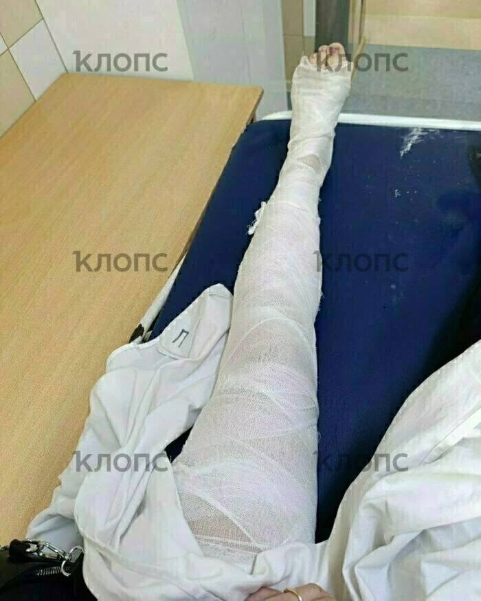 От удара потеряла сознание: в Калининграде на пешеходном переходе сбили маму с 5-летней дочкой От удара потеряла сознание: в Калининграде на пешеходном переходе сбили маму с 5-летней дочкой