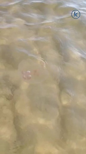 Калининградские учёные предложили использовать коллаген из медуз для лечения ожогов