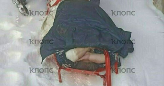 Под Зеленоградском врачам потребовалась помощь спасателей, чтобы вынести женщину весом 200 кг со второго этажа дома к машине скорой (фото)