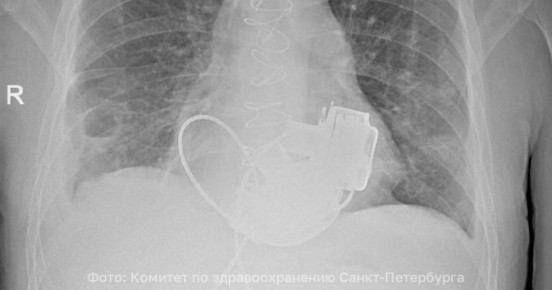 ������ ��� ������, � ������ ������ � ��� ��������� ������: � ������ ������� �������� �������������� ��� ���������