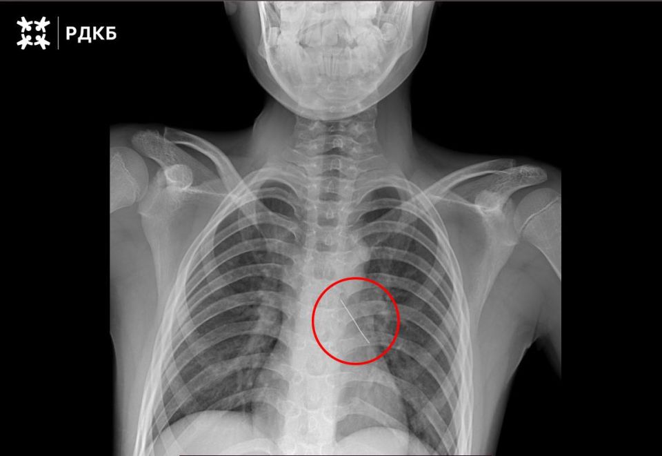 �������, ����������� �������, ������ ���������� �������