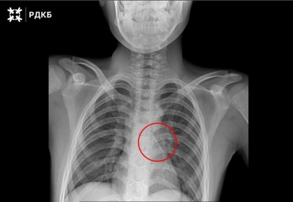 �������, ����������� �������, ������ ���������� �������